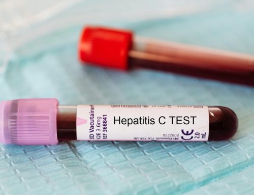 Update on New York’s hepatitis c transmission